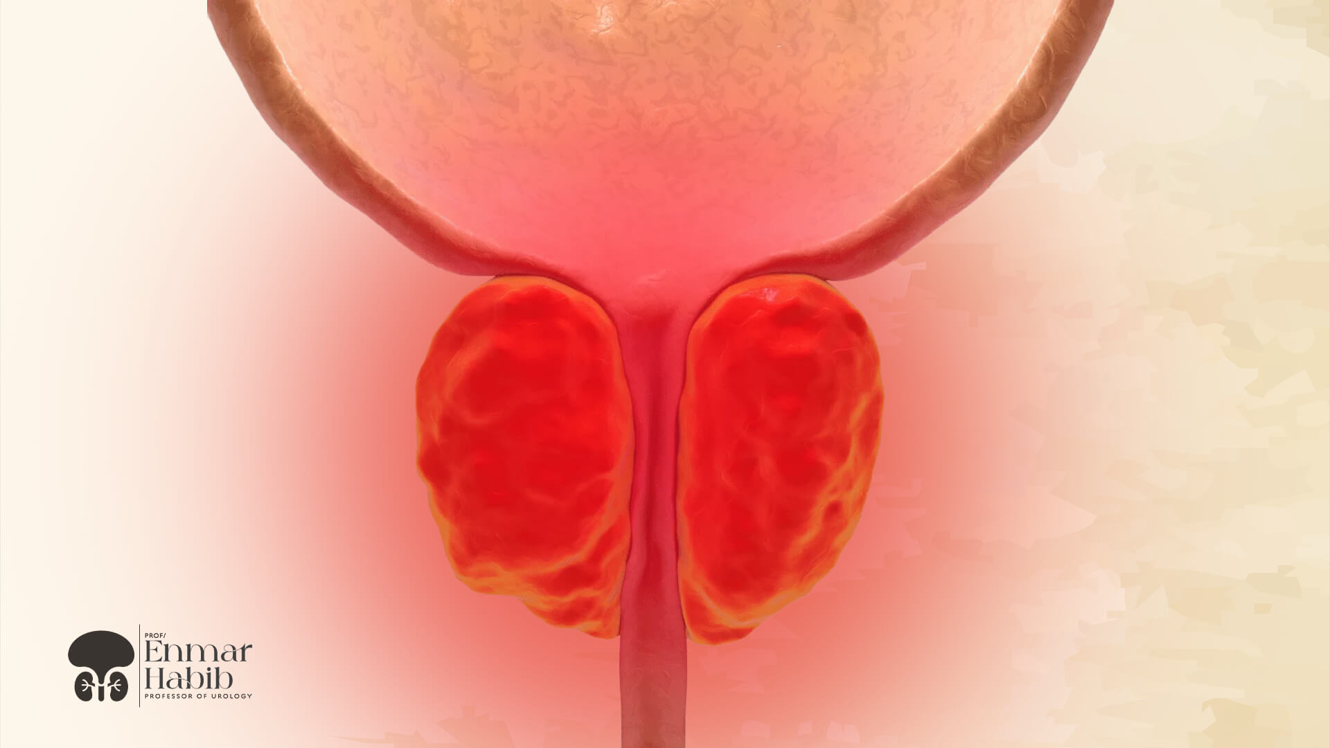 Prostatitis-and-Treatment-Methods Prostatitis-and-Treatment-Methods