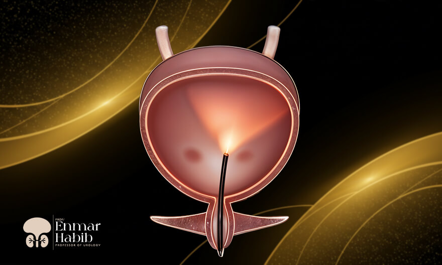 Urethrotomy-For-Urethral-Stricture-Treatment Urethrotomy-For-Urethral-Stricture-Treatment